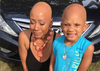 All The Feels: This Woman Embraced Her Alopecia And Inspired A Young Girl To Do The Same