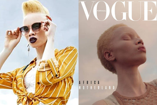 South African Model Blazes Trail as First Person With Albinism to Cover Vogue